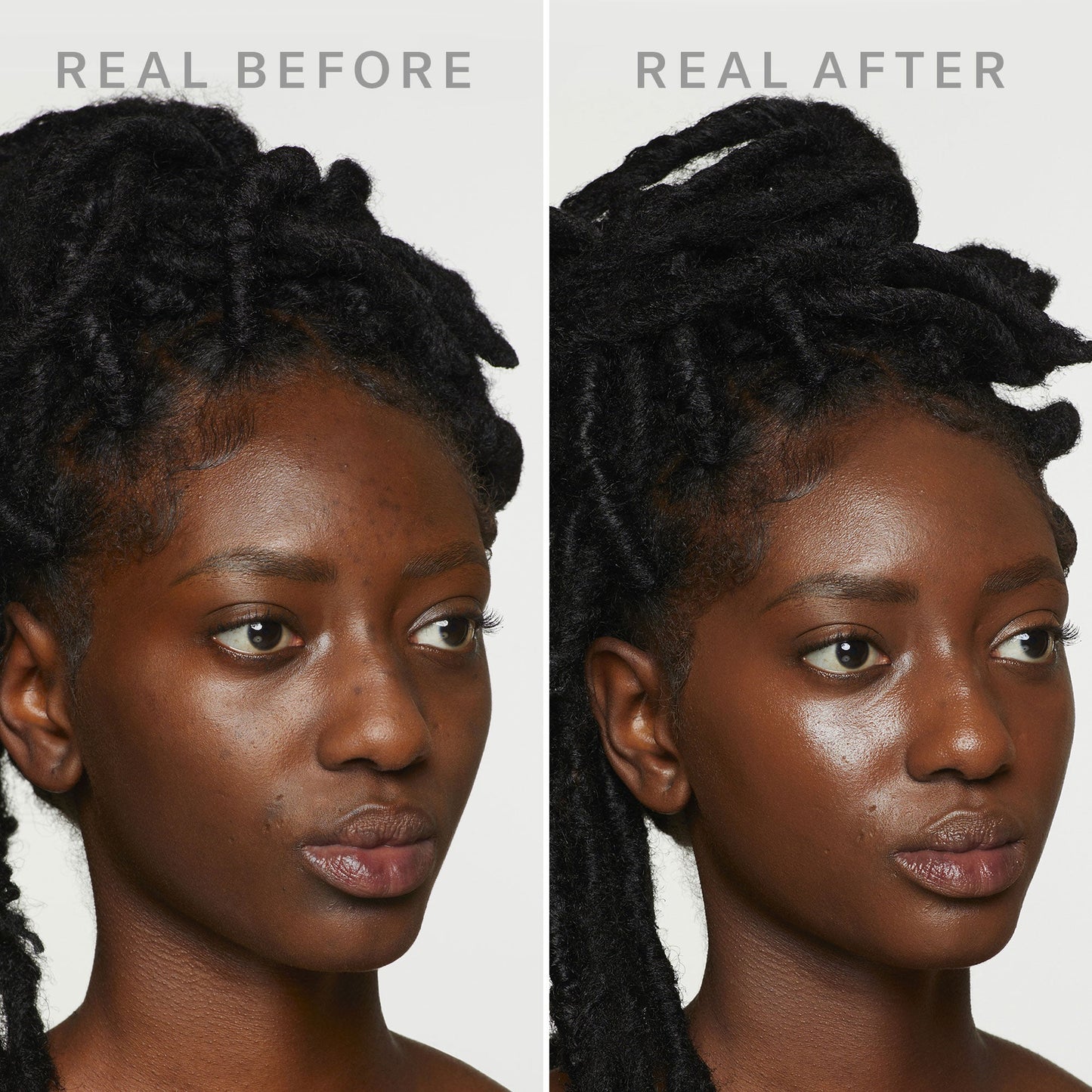 DEW SHIELD - BB CREAM & SKIN CARE in 1